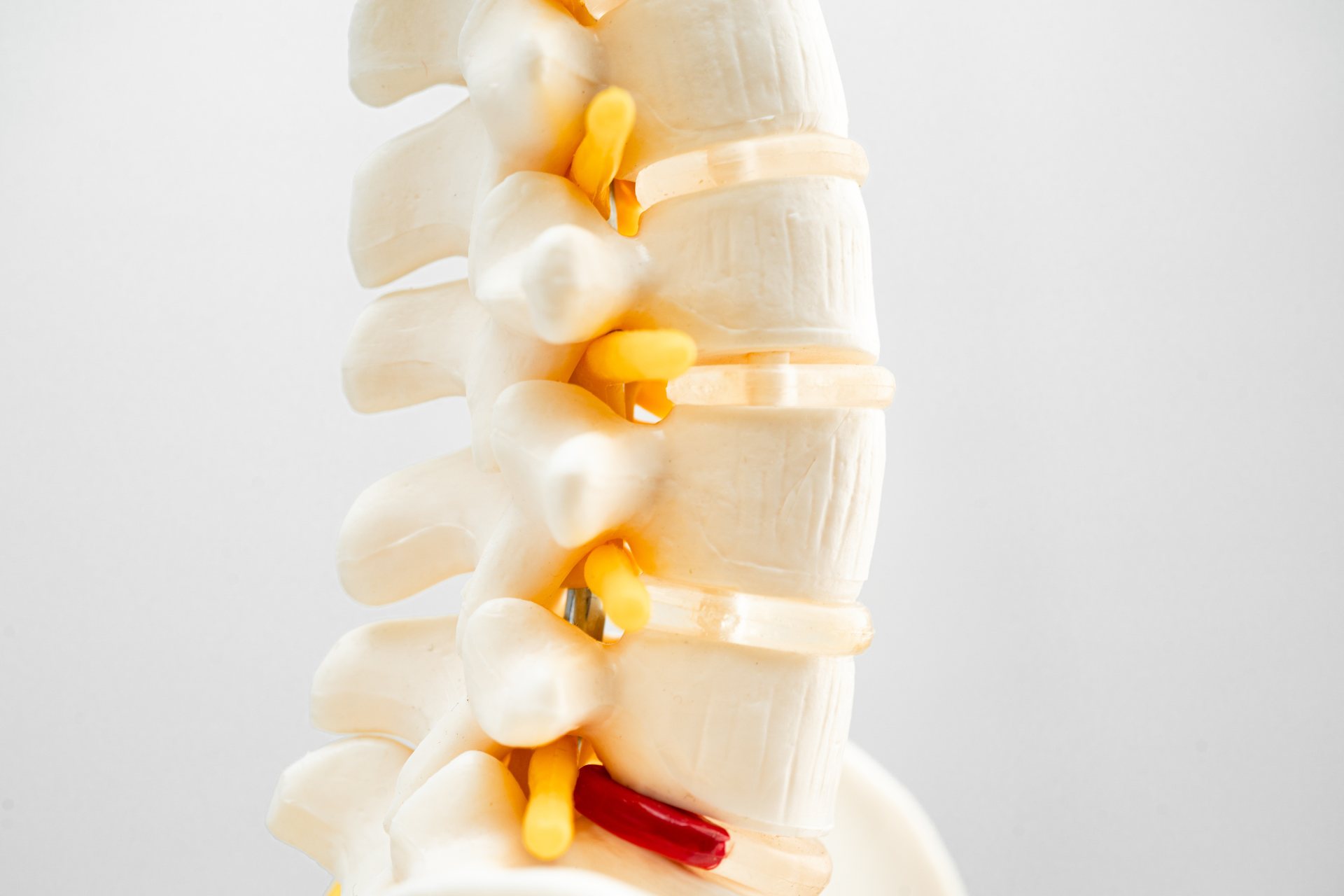 Exploring Non-surgical Back Pain Treatment Options: Spinal Decompression Therapy