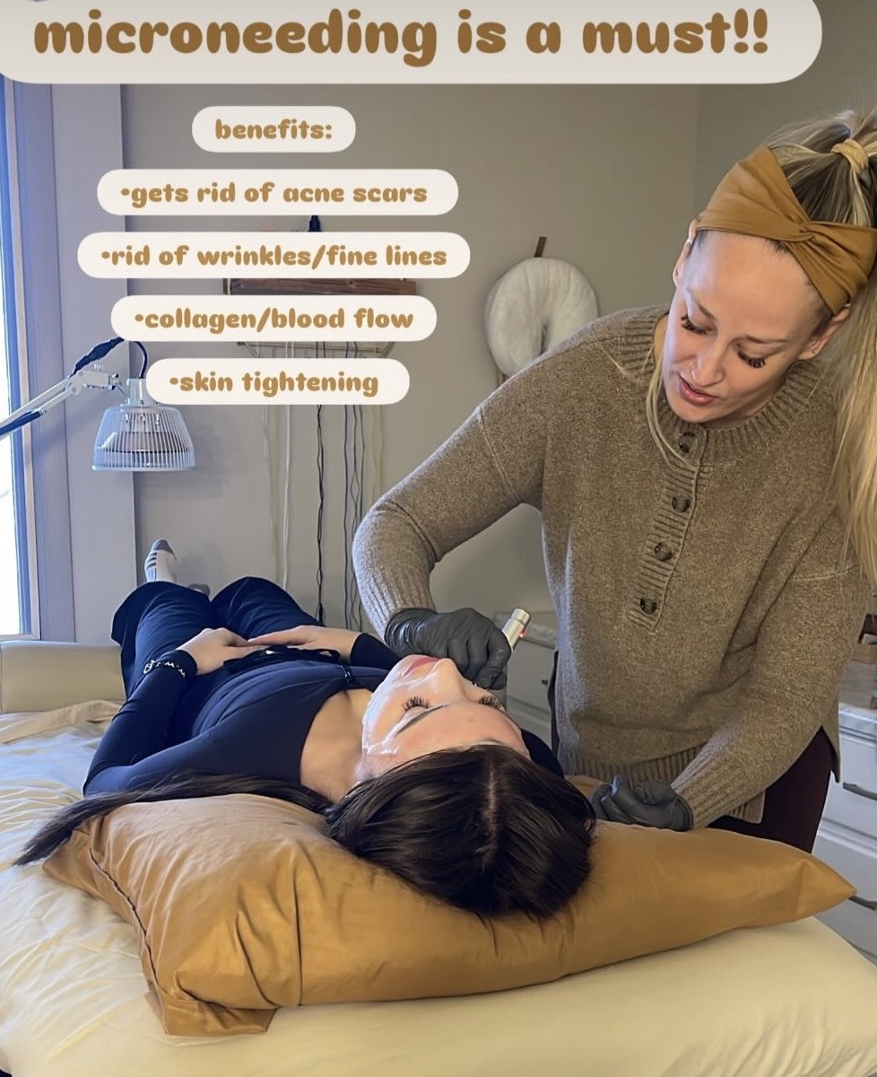 Introducing Microneedling at Golden Legacy Wellness