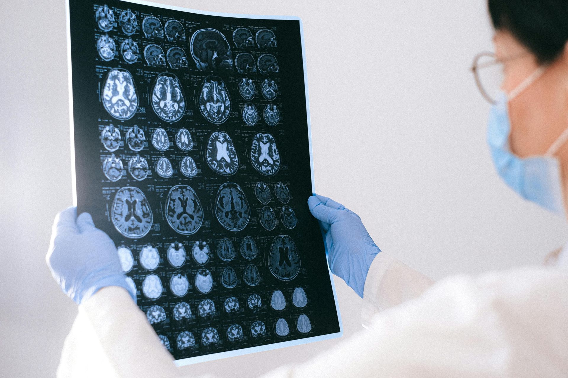 How brain injuries affect the memory