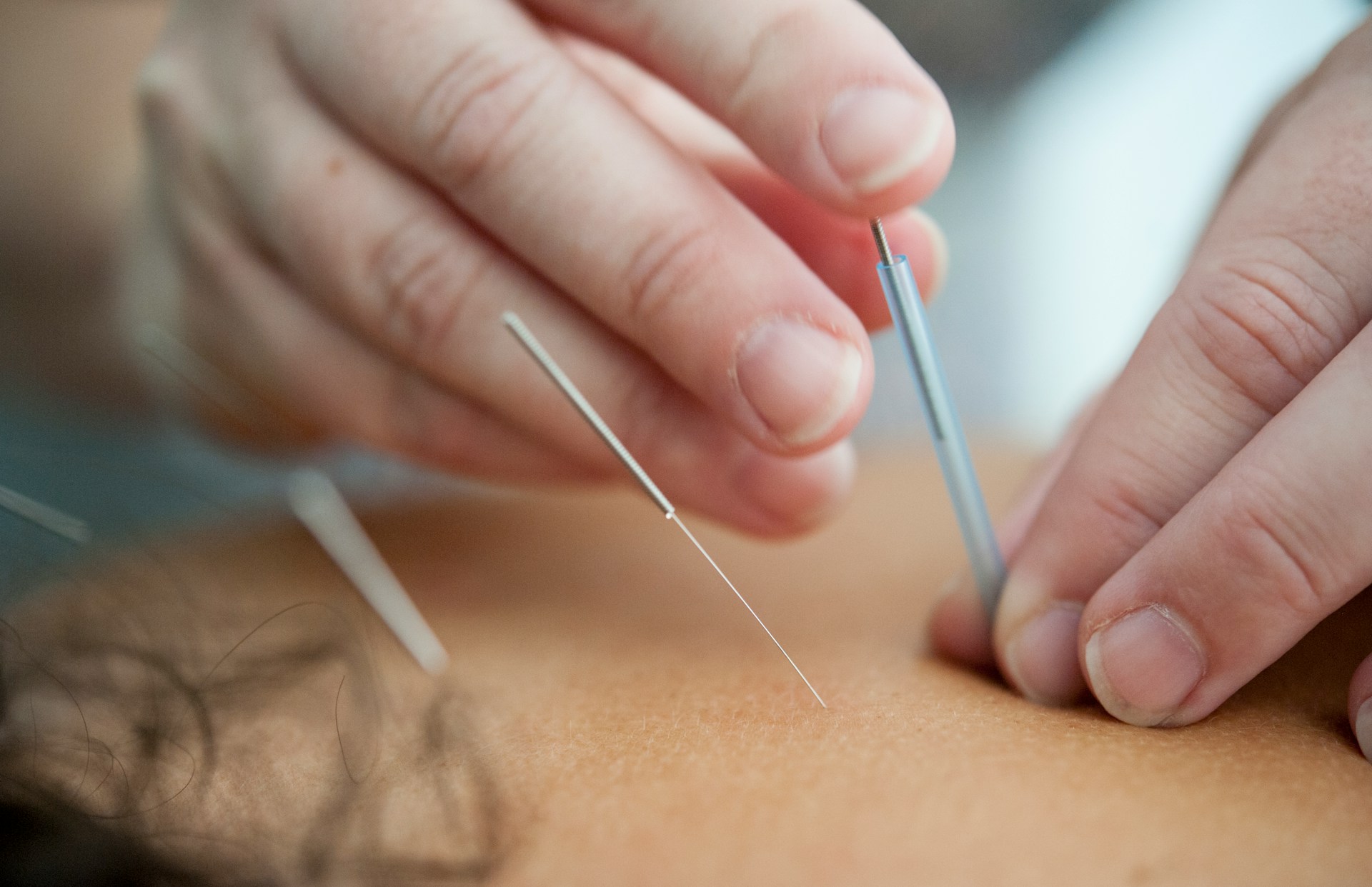 Why Your Body May Benefit From a Wellness Routine: The Case for Regular Acupuncture