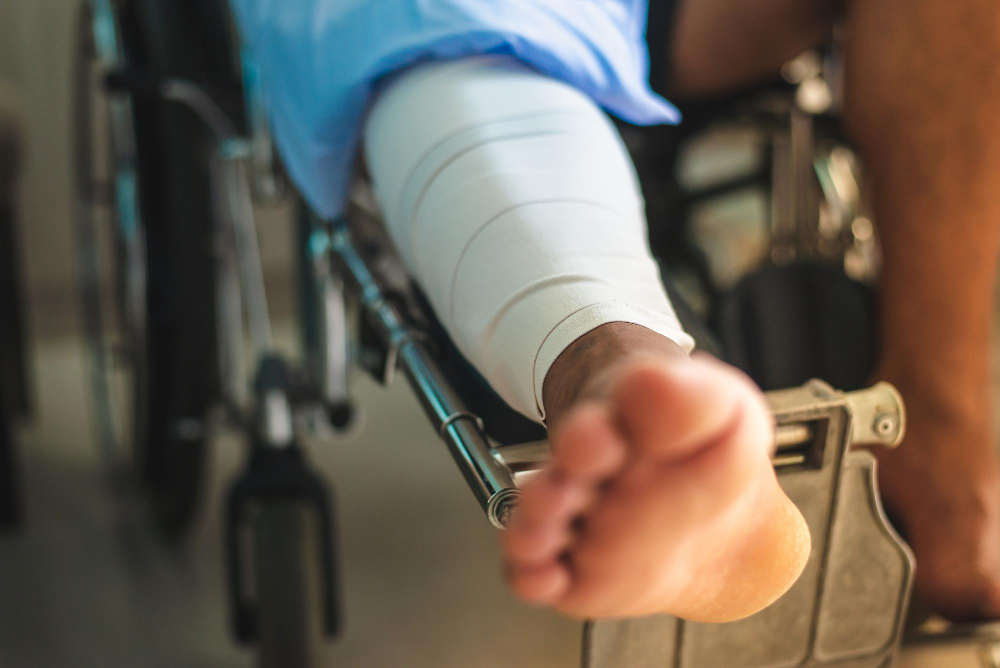 Close-up of a person in a wheelchair with a bandaged leg.